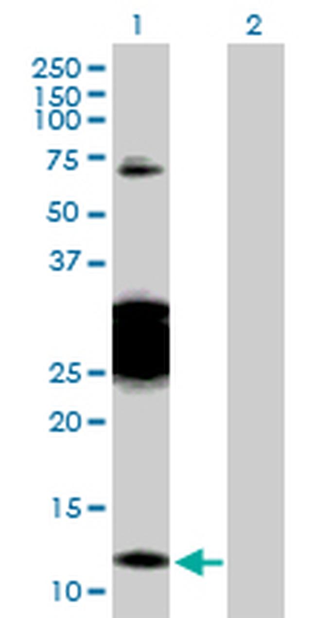 CBY1 Antibody in Western Blot (WB)