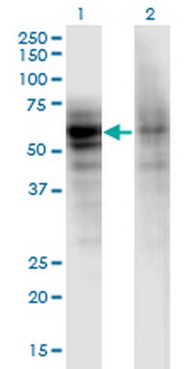 DSTYK Antibody in Western Blot (WB)