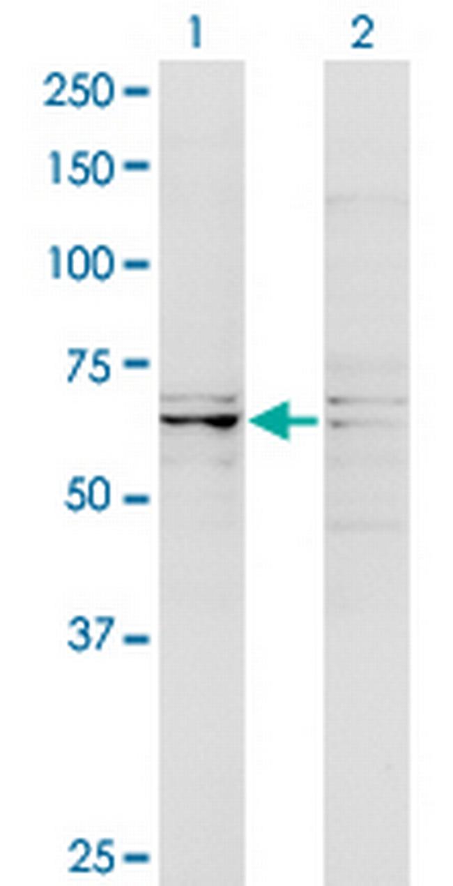 DSTYK Antibody in Western Blot (WB)