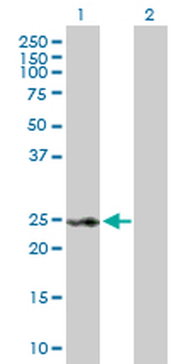 RAD54B Antibody in Western Blot (WB)
