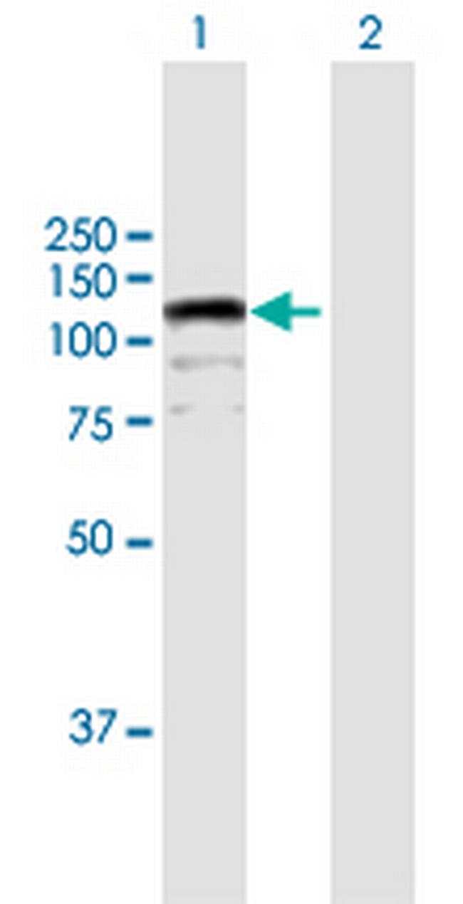CIZ1 Antibody in Western Blot (WB)
