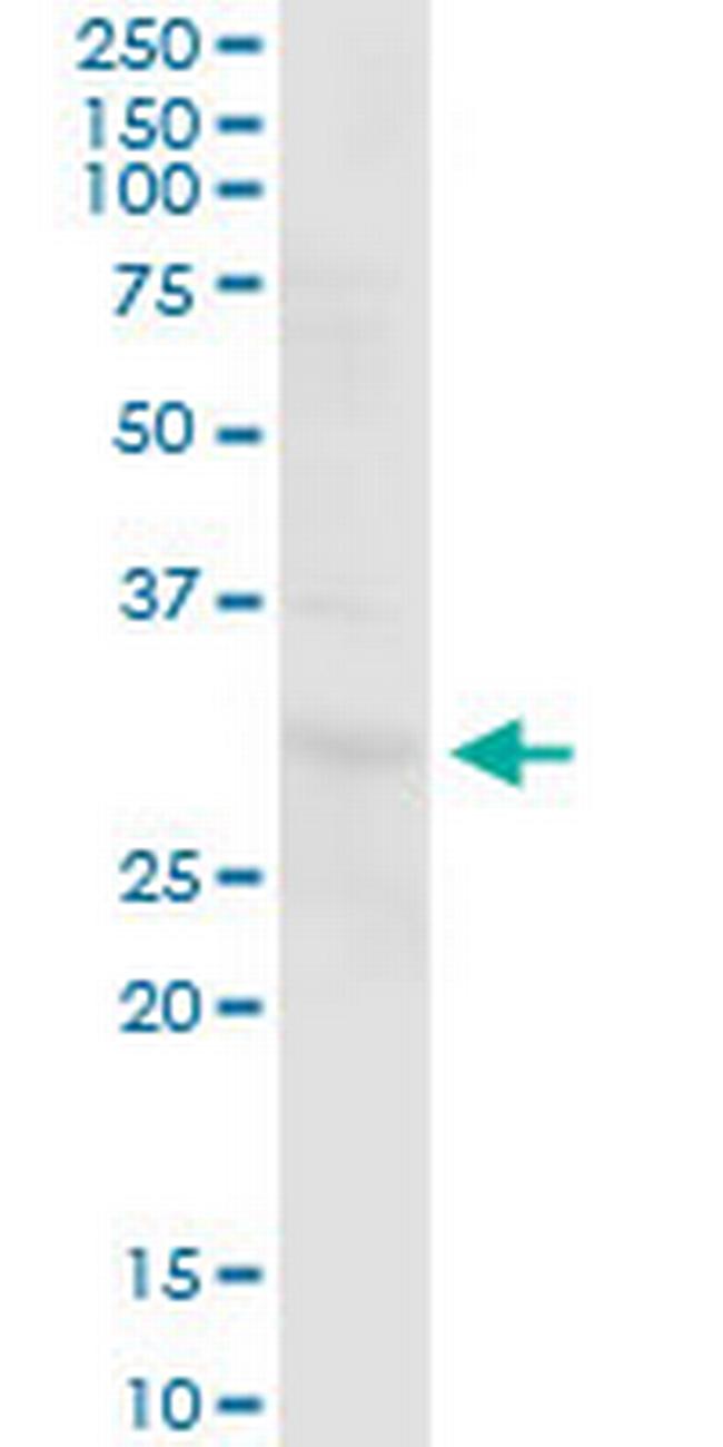 PGLS Antibody in Western Blot (WB)