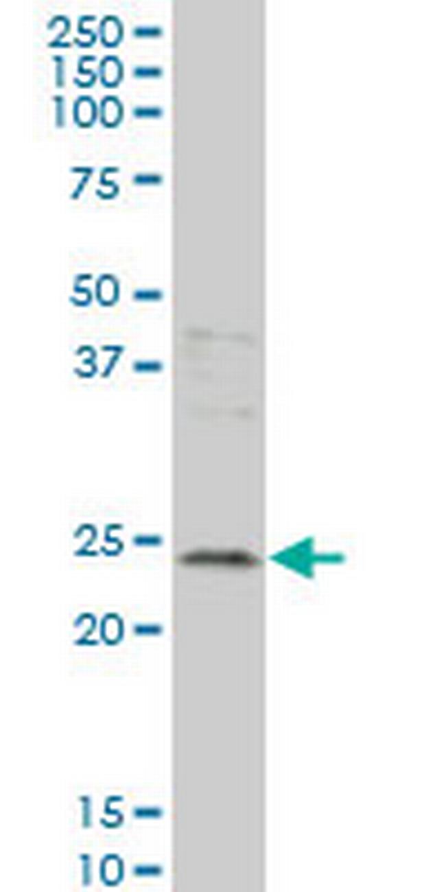 GCA Antibody in Western Blot (WB)
