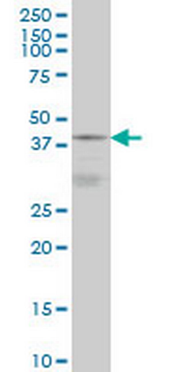 DNAJB5 Antibody in Western Blot (WB)