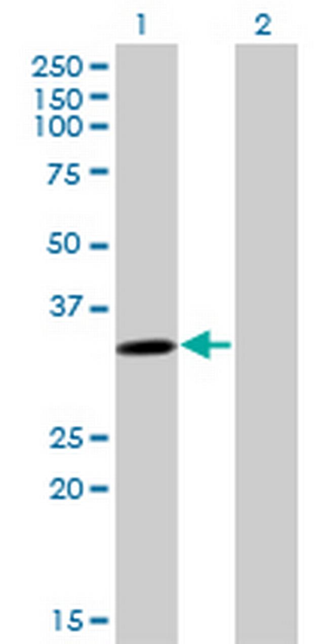 SULT4A1 Antibody in Western Blot (WB)