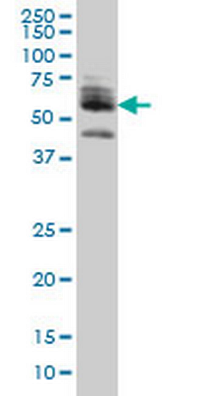 ZNF345 Antibody in Western Blot (WB)