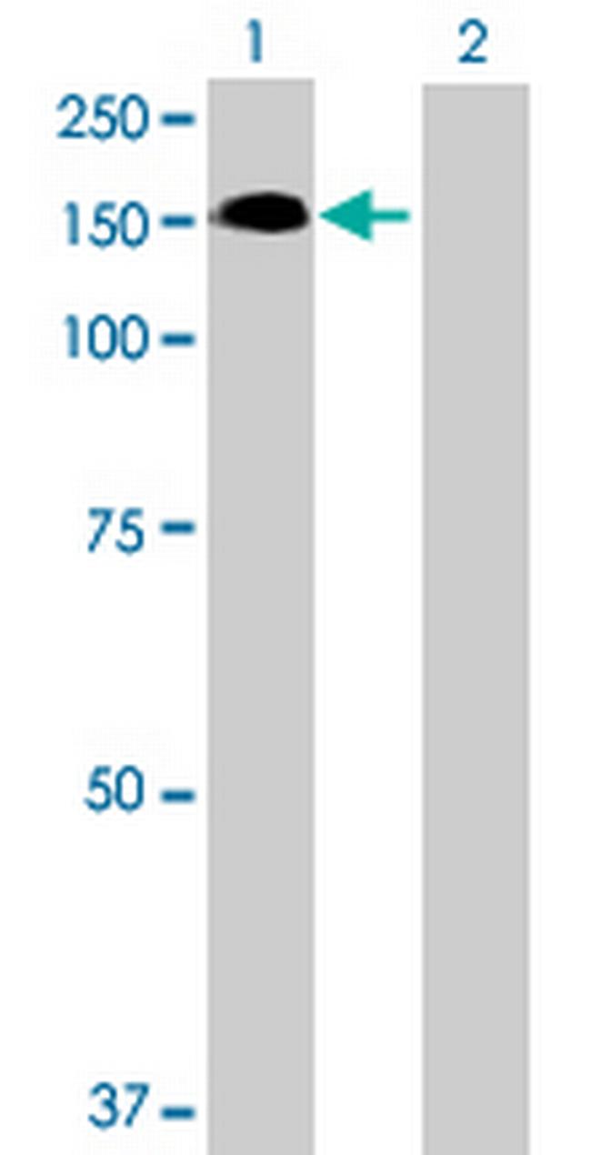 DKFZP434B03P35 Antibody in Western Blot (WB)