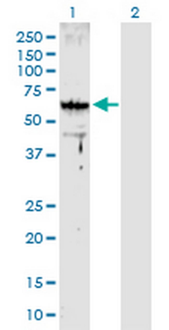 ARMC8 Antibody in Western Blot (WB)
