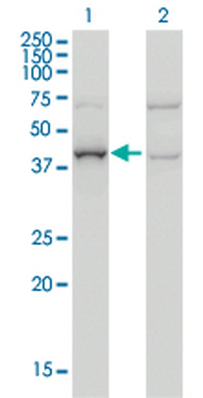 ARMC8 Antibody in Western Blot (WB)