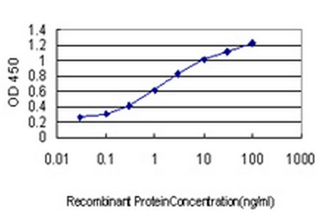 DFNB31 Antibody in ELISA (ELISA)
