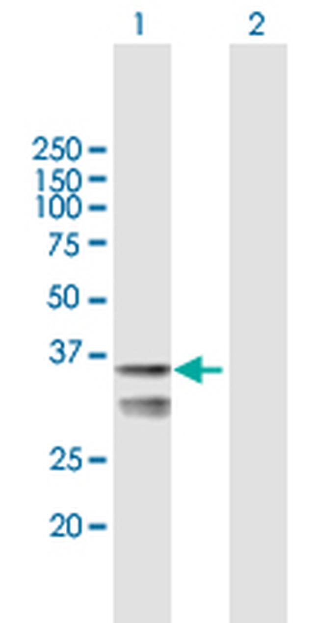 LETMD1 Antibody in Western Blot (WB)