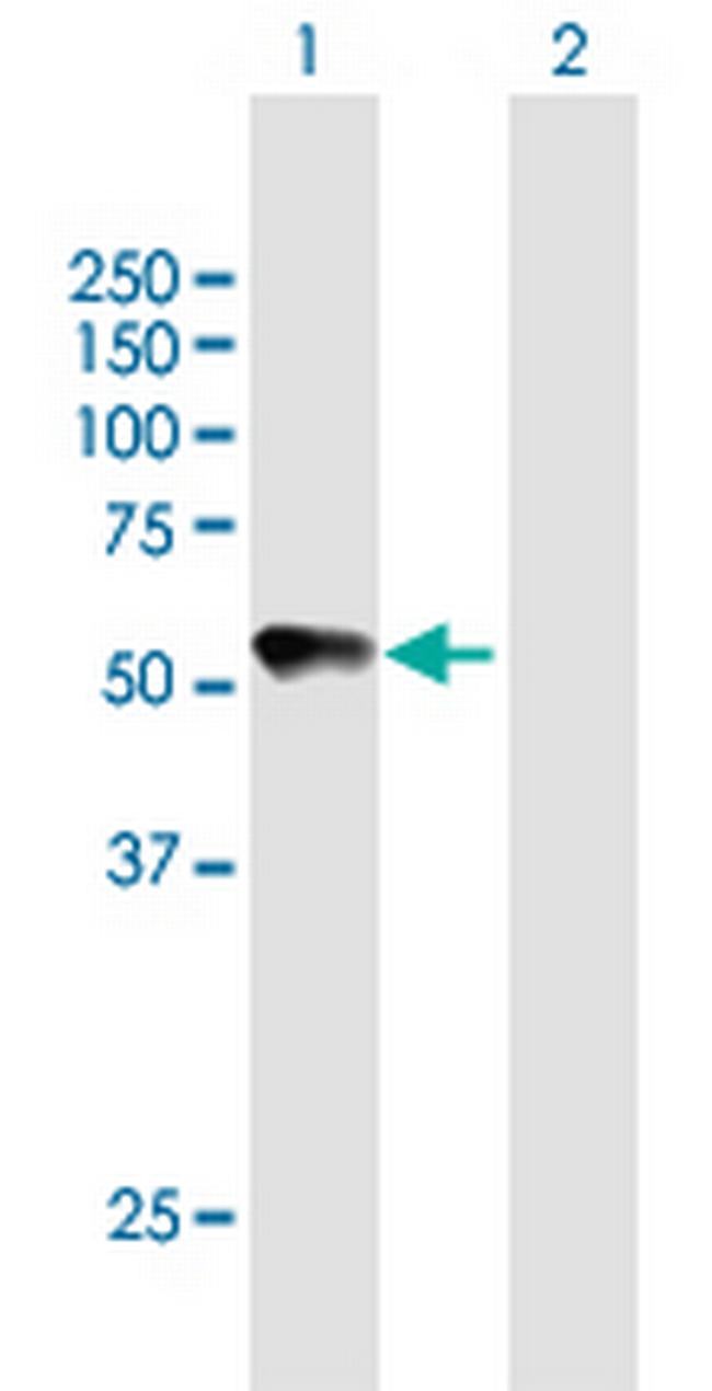 CHRDL2 Antibody in Western Blot (WB)