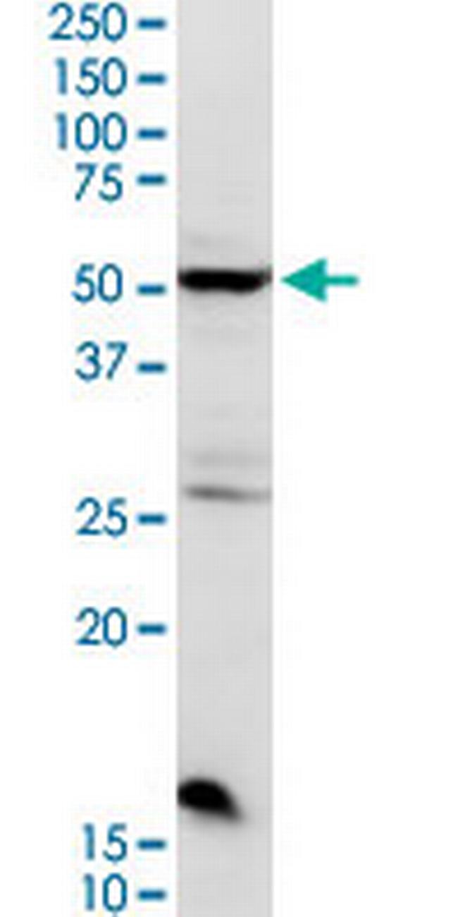 CHRDL2 Antibody in Western Blot (WB)