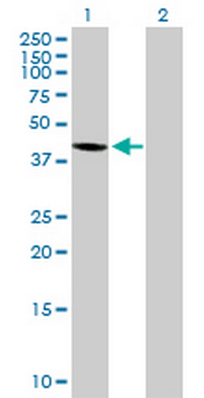 WDR51A Antibody in Western Blot (WB)