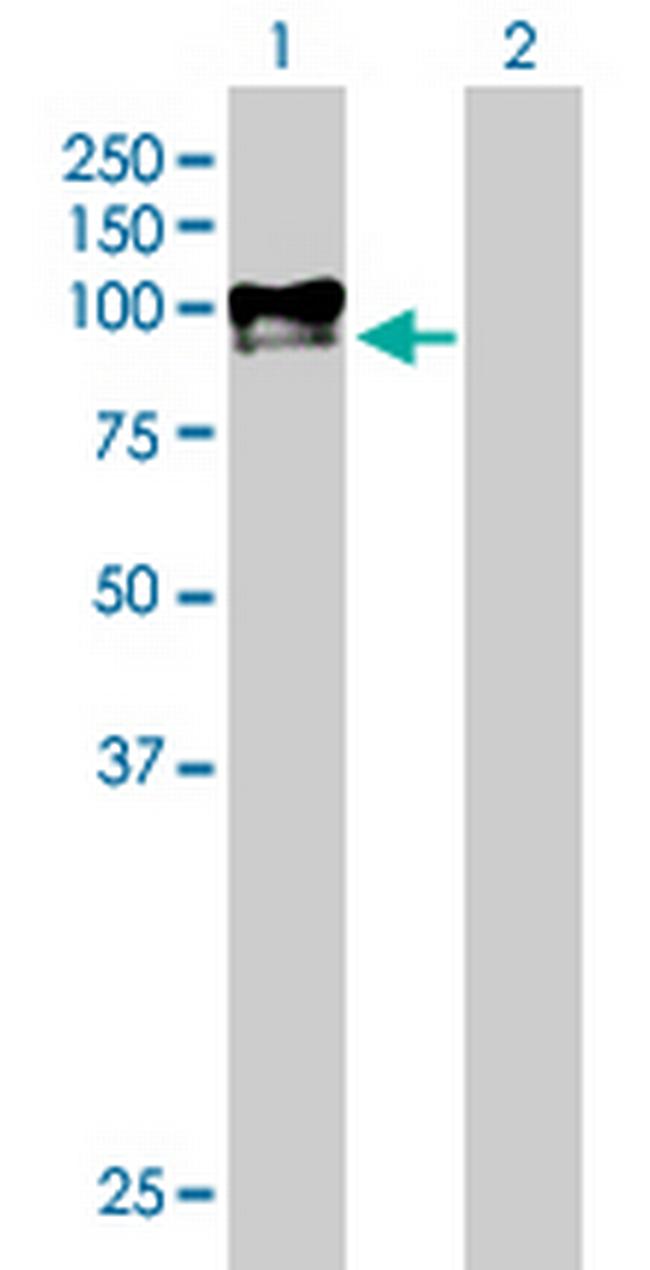 DKFZP586H2123 Antibody in Western Blot (WB)