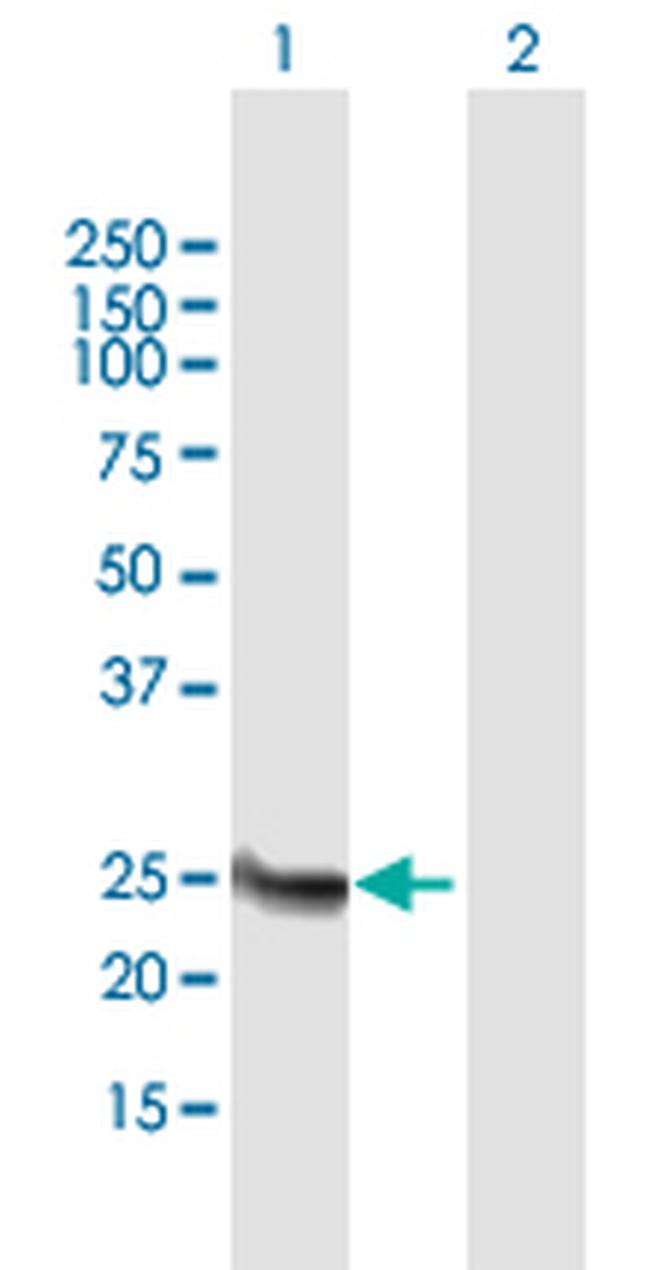 FAM119B Antibody in Western Blot (WB)