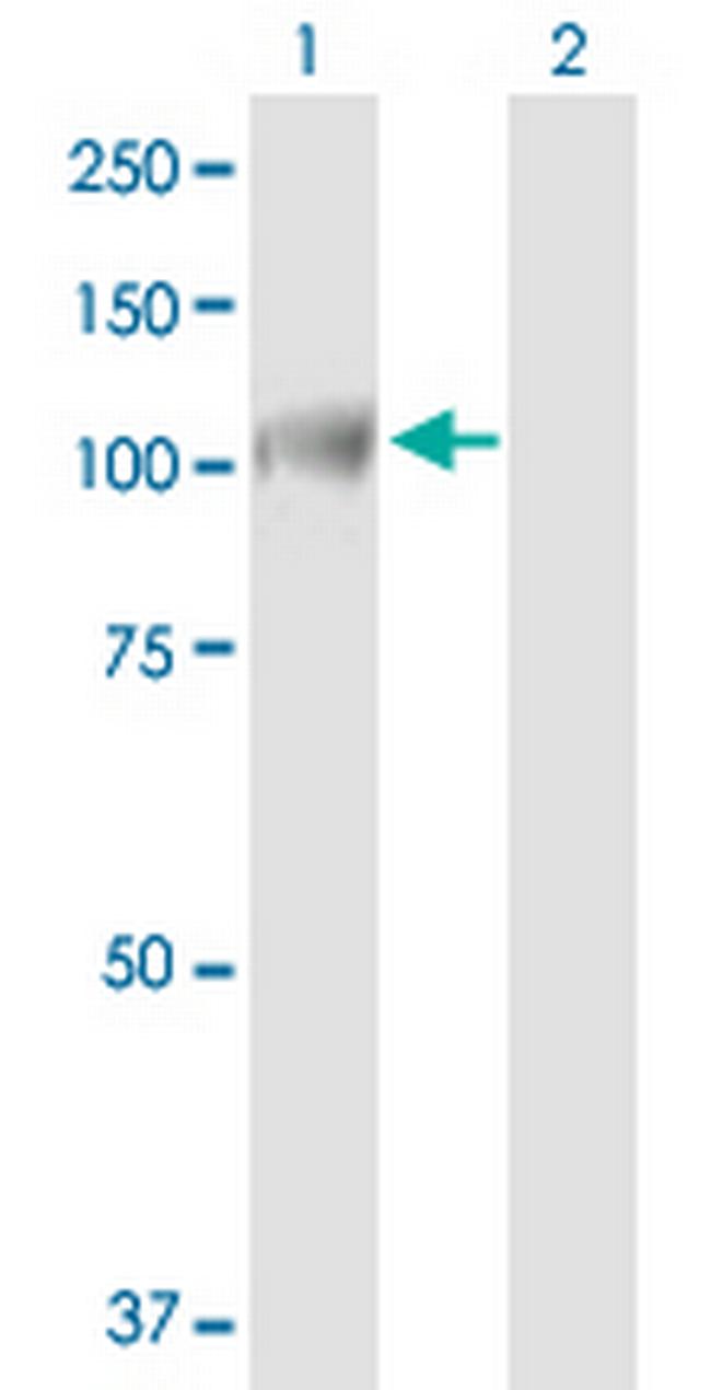 INTS7 Antibody in Western Blot (WB)