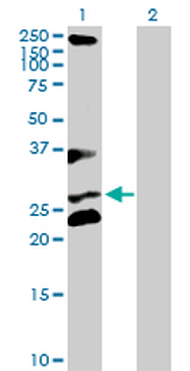 RCHY1 Antibody in Western Blot (WB)