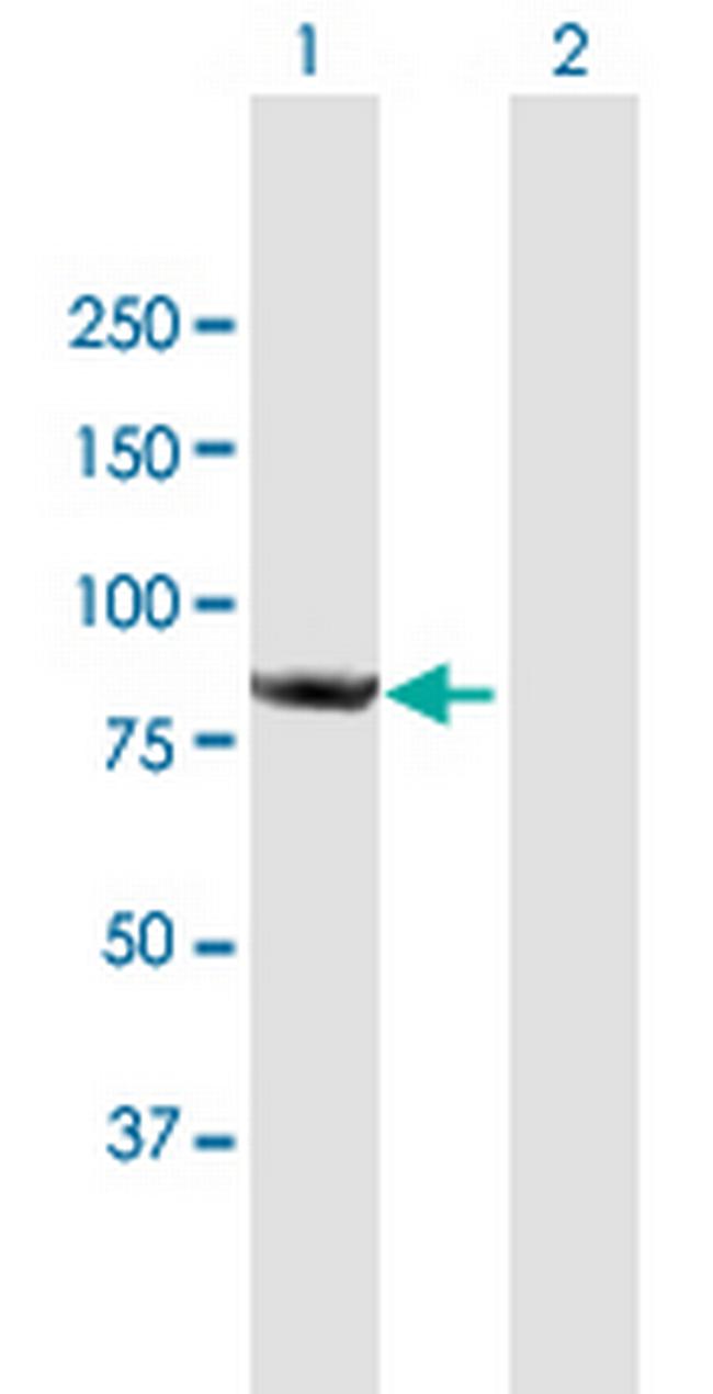 CNOT10 Antibody in Western Blot (WB)