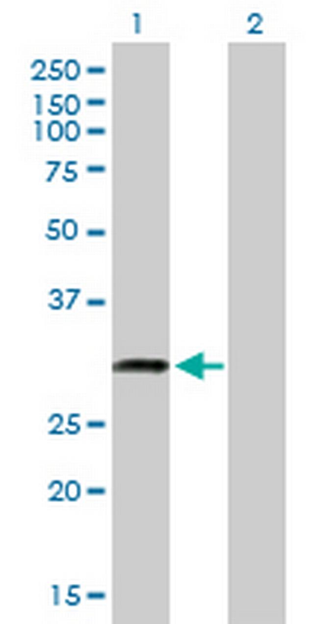 C18orf10 Antibody in Western Blot (WB)