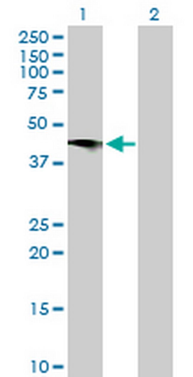 C2CD2 Antibody in Western Blot (WB)