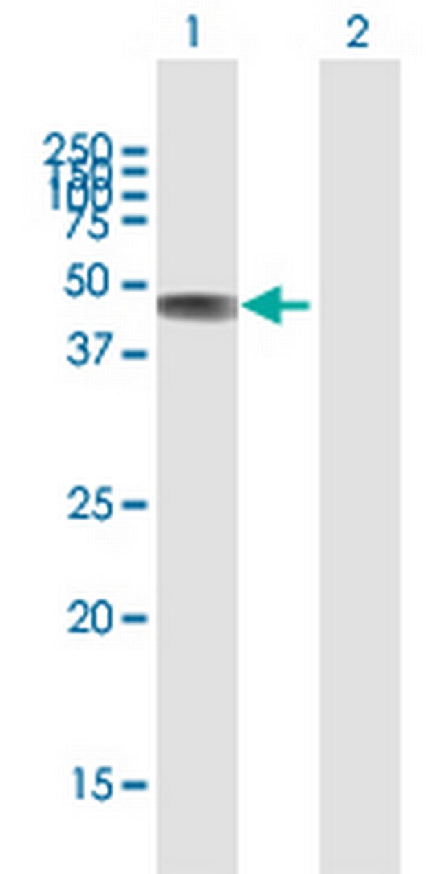 C2CD2 Antibody in Western Blot (WB)