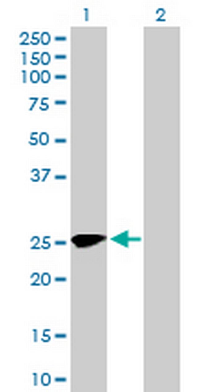 MMACHC Antibody in Western Blot (WB)