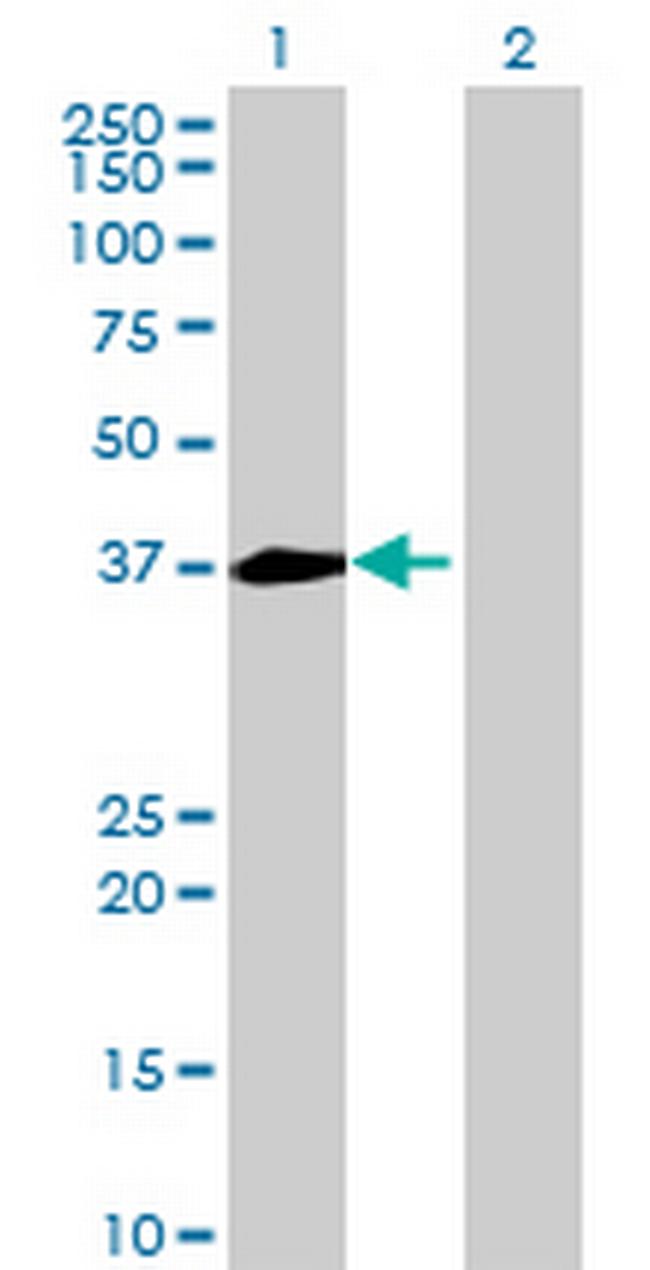 NECAP1 Antibody in Western Blot (WB)