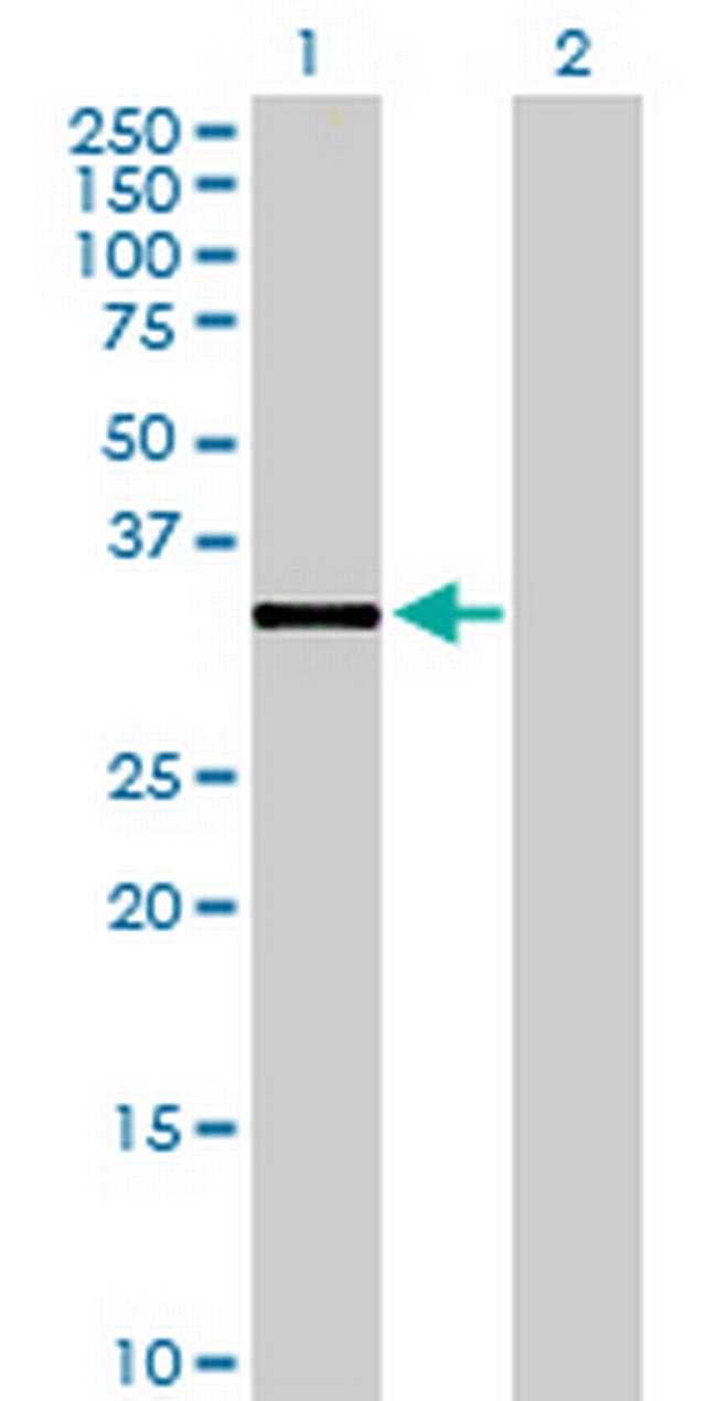 DHRS7B Antibody in Western Blot (WB)