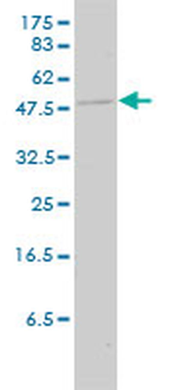 KRT23 Antibody in Western Blot (WB)