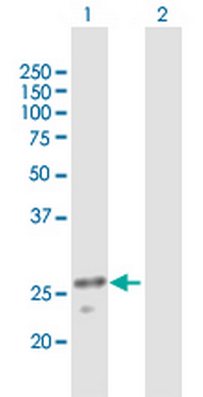 ULK3 Antibody in Western Blot (WB)
