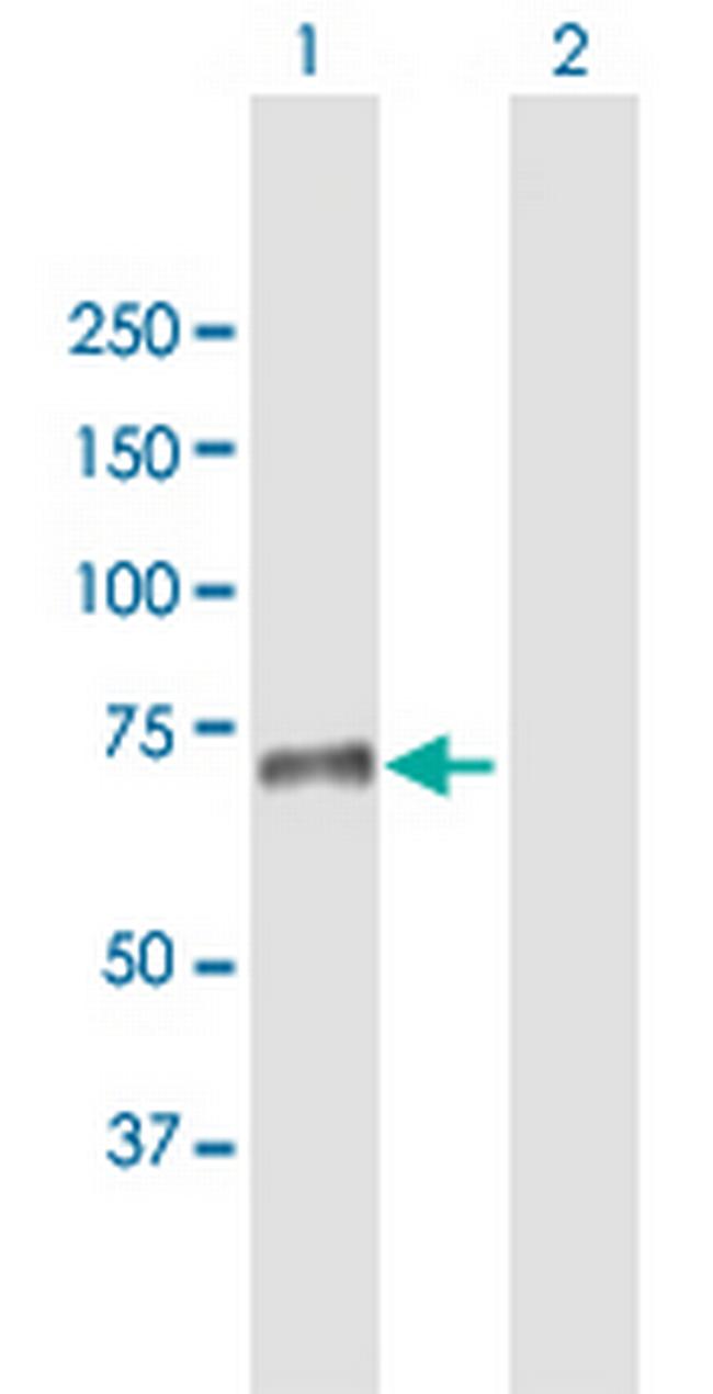 SNED1 Antibody in Western Blot (WB)