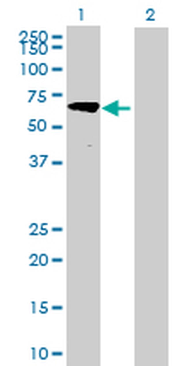 DNAPTP6 Antibody in Western Blot (WB)