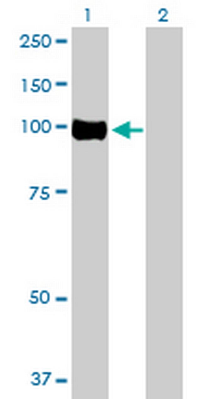 OSBPL3 Antibody in Western Blot (WB)