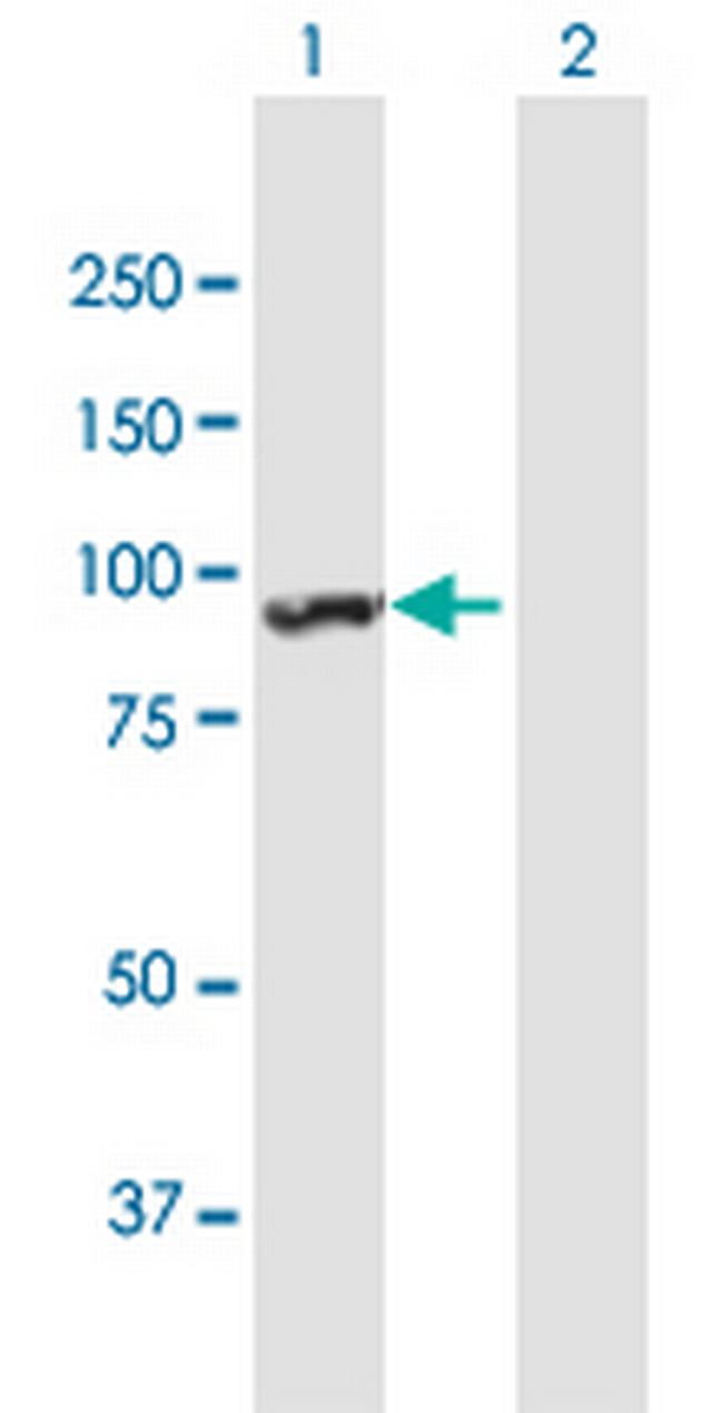 ANKRD17 Antibody in Western Blot (WB)