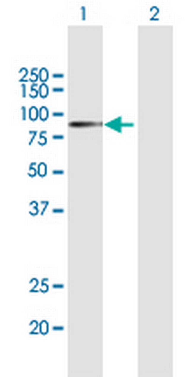 APPL1 Antibody in Western Blot (WB)