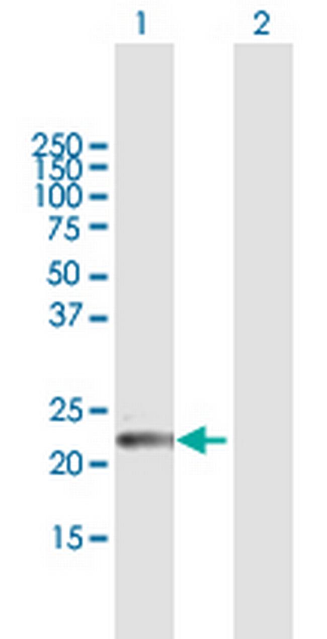 GPSM1 Antibody in Western Blot (WB)
