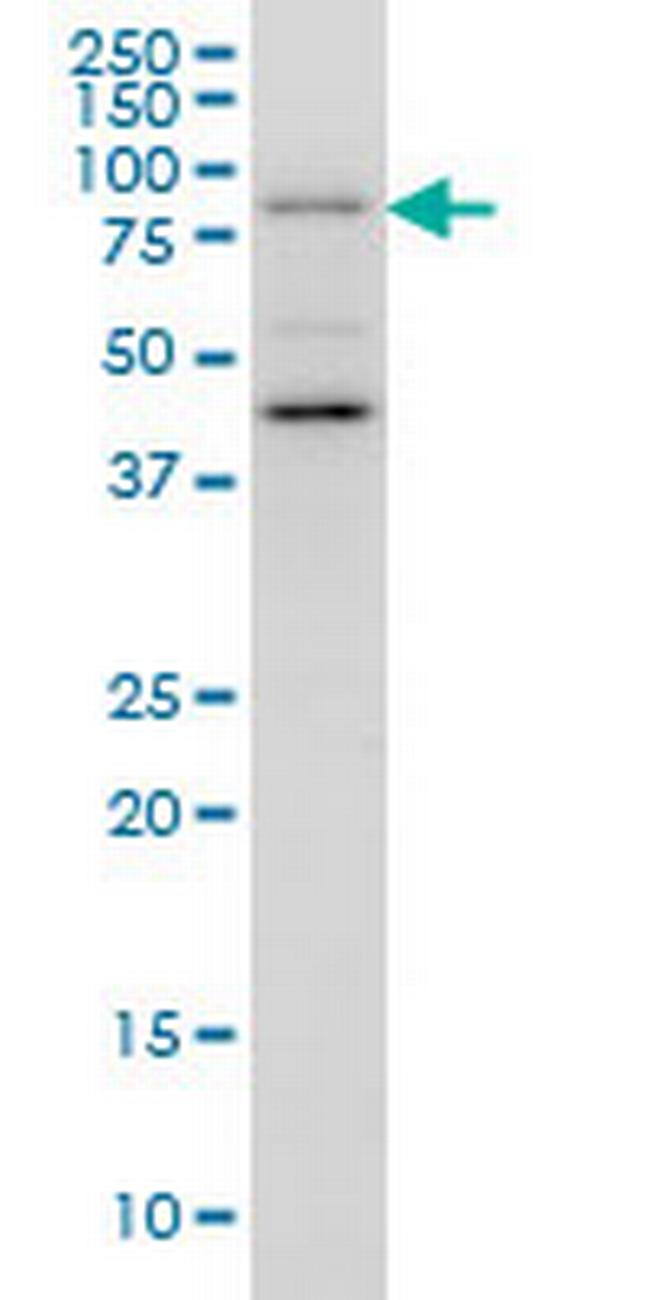 GGA1 Antibody in Western Blot (WB)