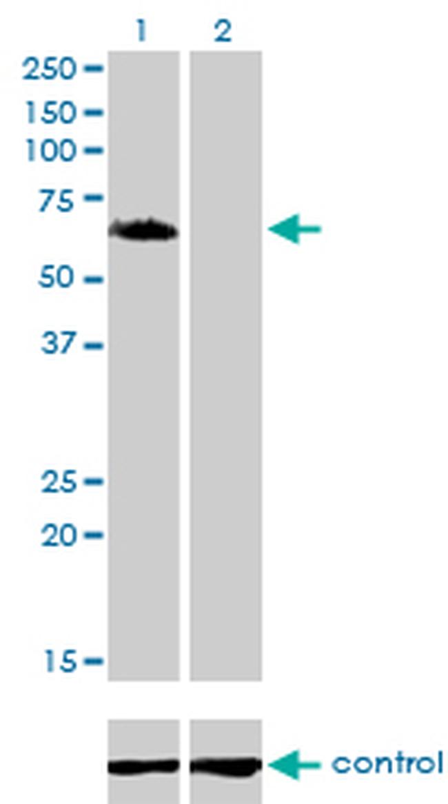 GGA1 Antibody in Western Blot (WB)
