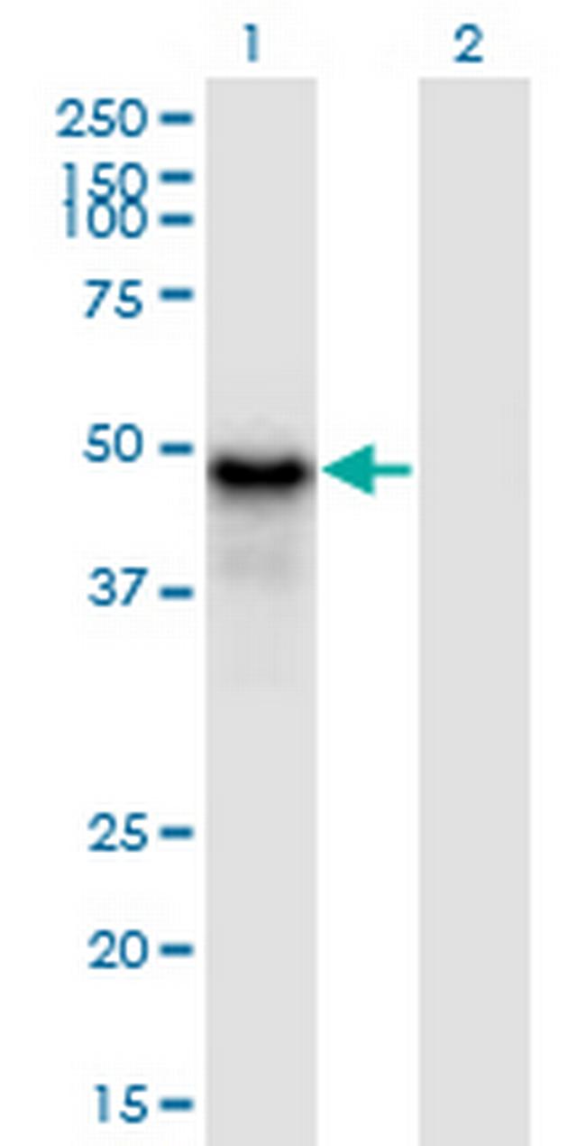 PYGO1 Antibody in Western Blot (WB)