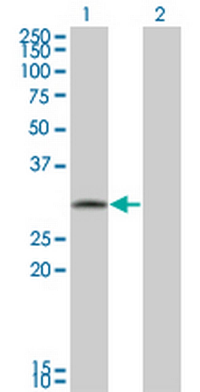 FGFR1OP2 Antibody in Western Blot (WB)