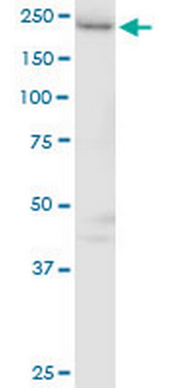 GAPVD1 Antibody in Western Blot (WB)