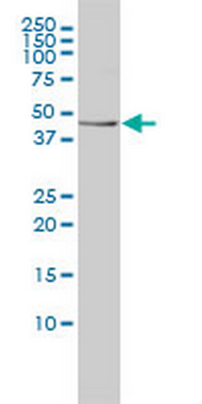 TES Antibody in Western Blot (WB)