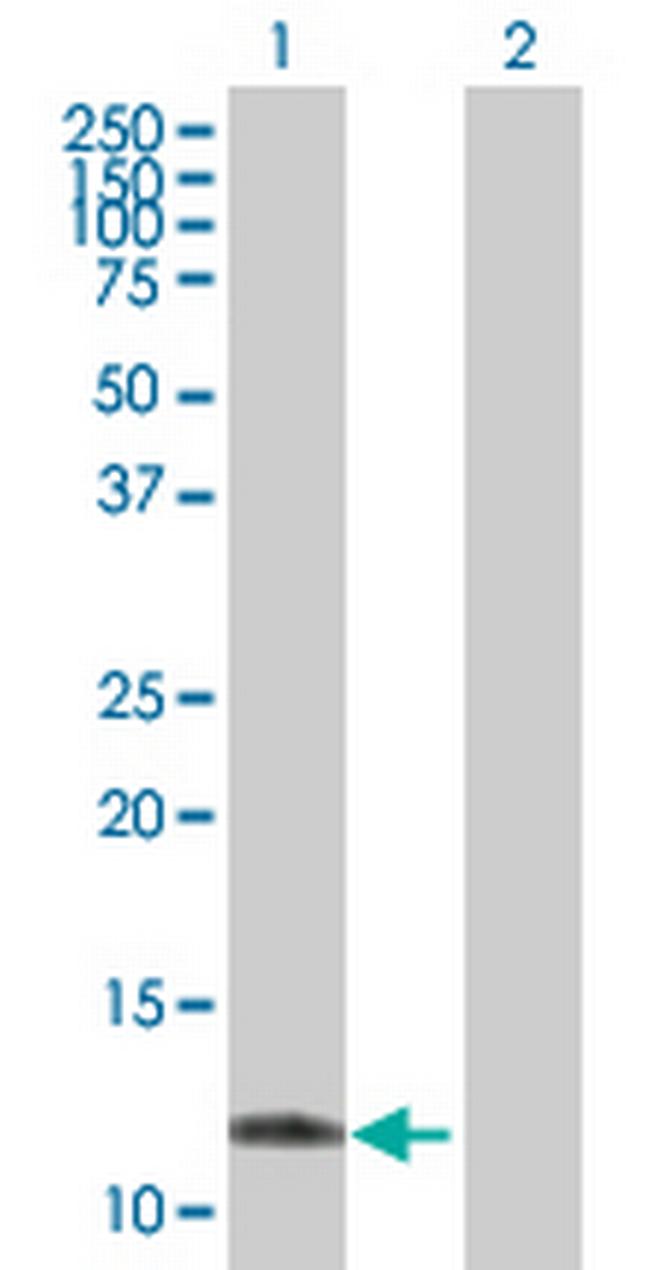 TTLL3 Antibody in Western Blot (WB)