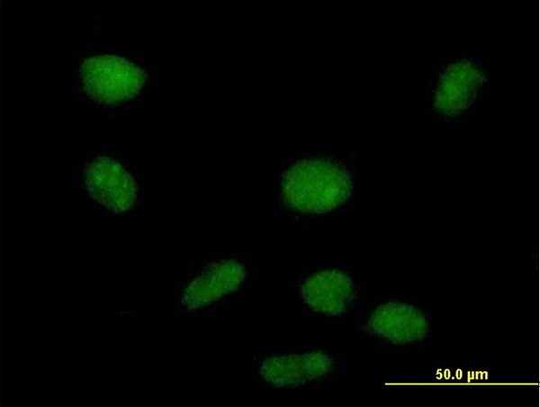 PHF19 Antibody in Immunocytochemistry (ICC/IF)