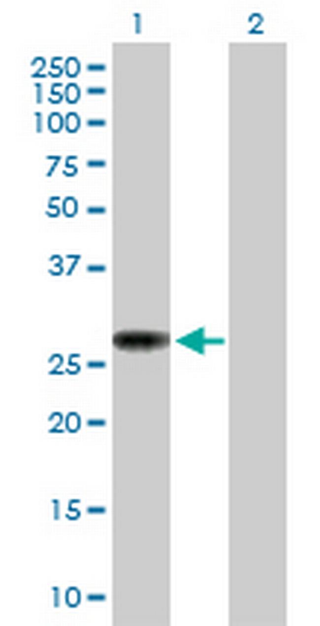 NAT9 Antibody in Western Blot (WB)