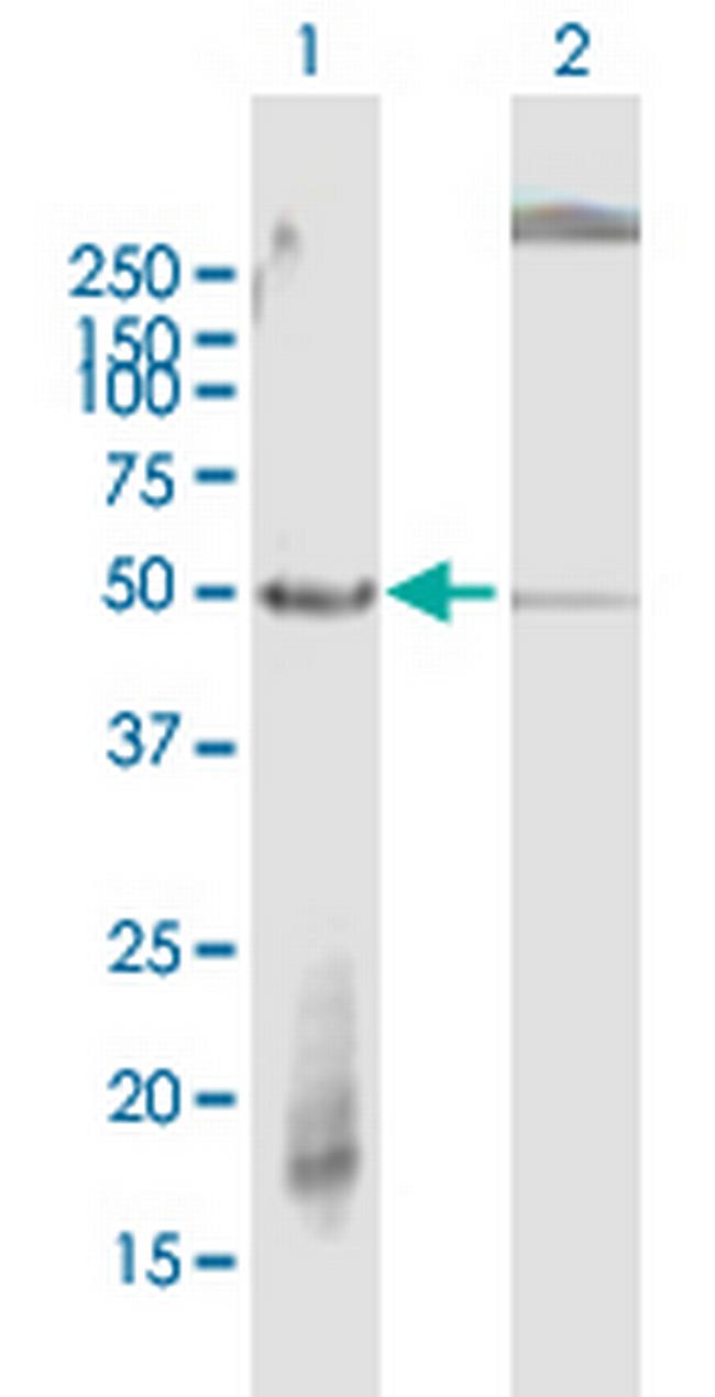 FBXW2 Antibody in Western Blot (WB)
