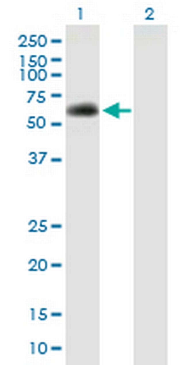 SPAG8 Antibody in Western Blot (WB)