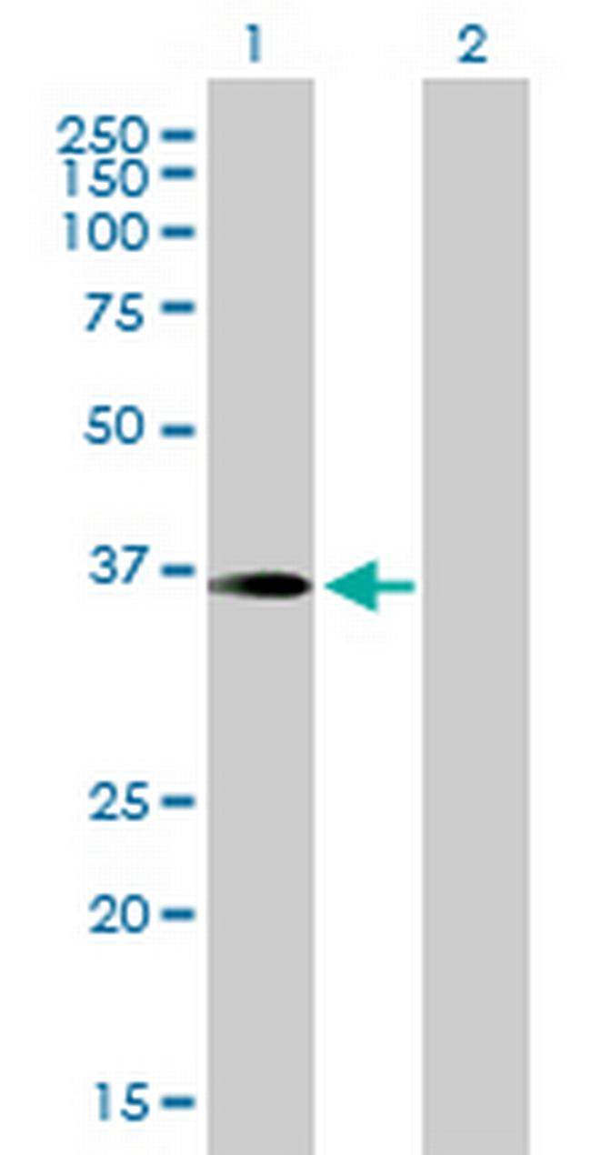 PITPNC1 Antibody in Western Blot (WB)