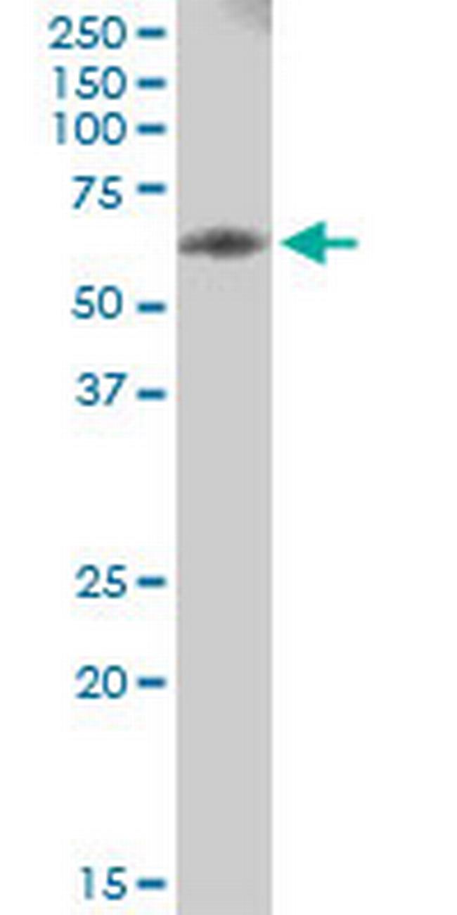 PHGDH Antibody in Western Blot (WB)